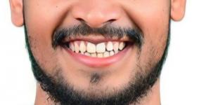 نادي جبة يوقع مخالصة مع حارس مرماه السلومي